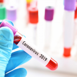 پکیج تست خون کرونا (IGG , IGM)